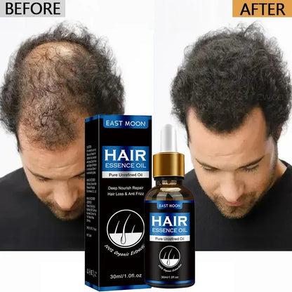 Hair Growth Oil. Proven Effective Rapid Repair!